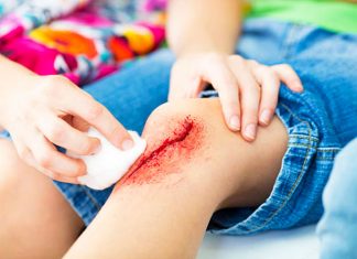 Как правильно лечить раны?