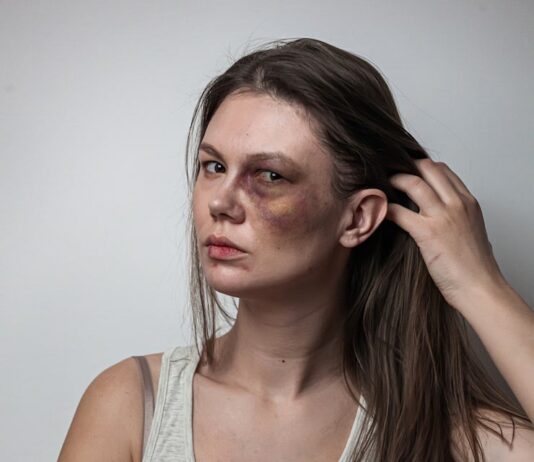 Значение прыща на виске слева у женщины